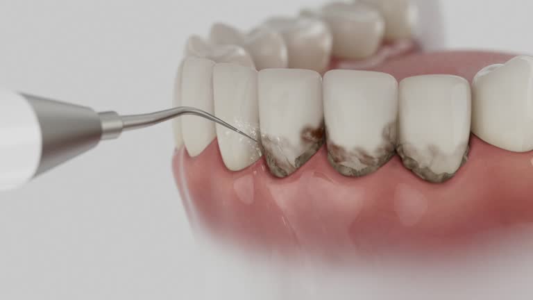 Reliable Dental Implants contractor in Franklin, TX by Smile Center Dentistry